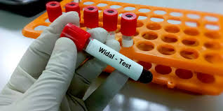 widal test 1