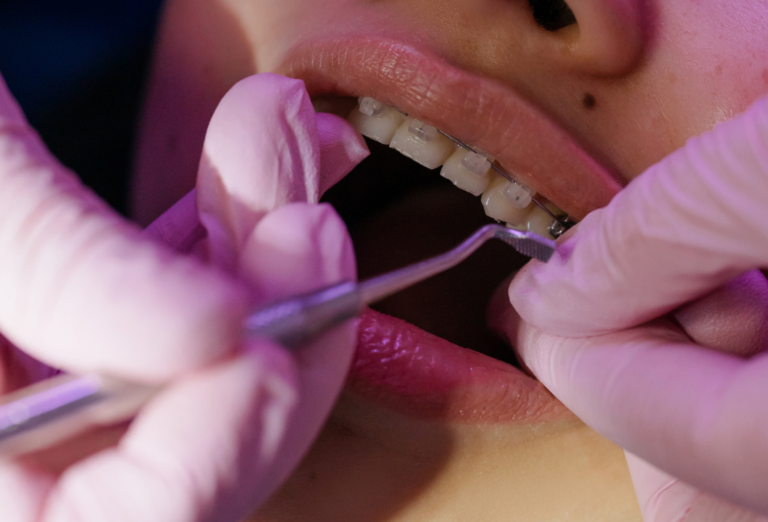 Types of Dental Care Explained: Simple and Effective Solutions